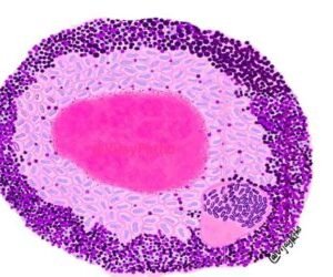 General Pathology Set of 50 Slides